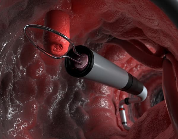 CPRE (Colangiopancreatografía Retrógrada Endoscópica) Una Técnica Avanzada para la Salud de sus Conductos Biliares y Pancreáticos CPRE (Colangiopancreatografía Retrógrada Endoscópica) Una Técnica Avanzada para la Salud de sus Conductos Biliares y Pancreáticos