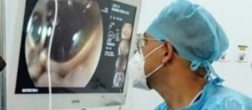 Endoscopía Superior Bariátrica